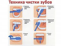 Проект учекника 2 класса Галинова Алексея Здоровые зубы-залог здоровья нашего организма!