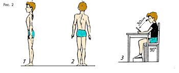 Реферат на темуПравильная осанка