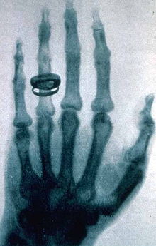Сабақ : Рентген сәлелері