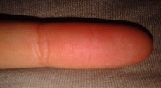 Связь индивидуально – психологических особенностей личности и дерматоглифических узоров на пальцах