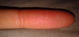 Связь индивидуально – психологических особенностей личности и дерматоглифических узоров на пальцах