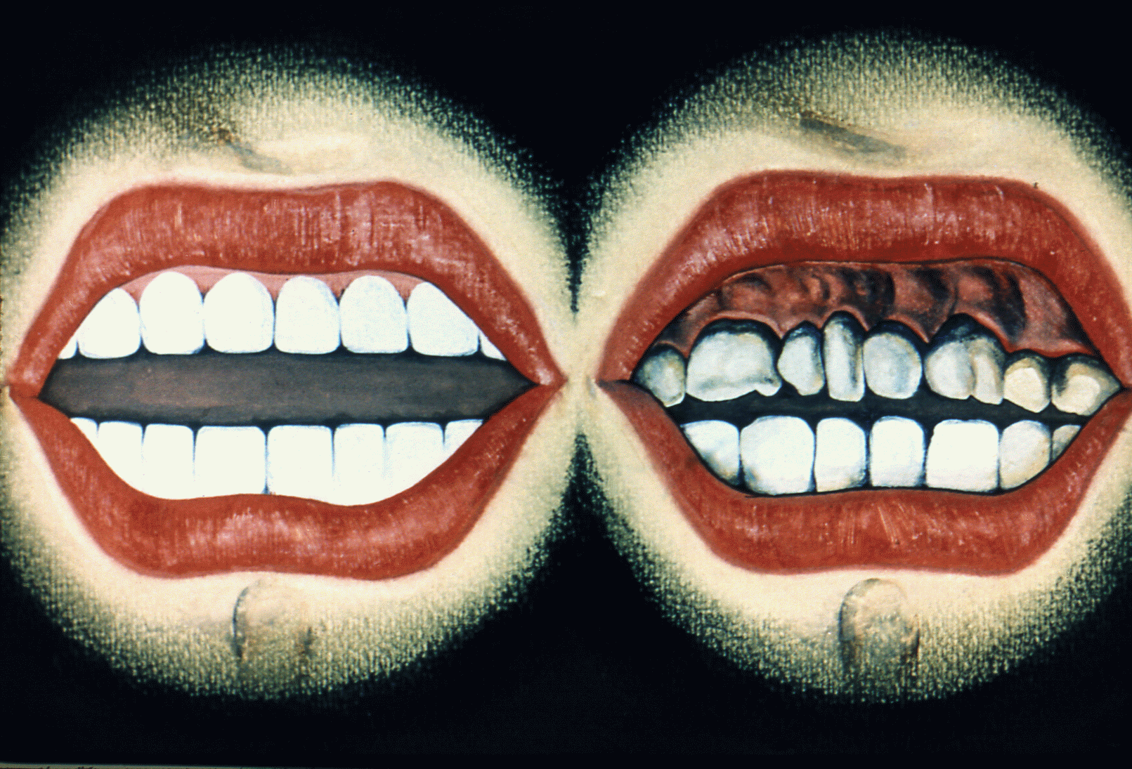 Исследовательская работа Как сохранить зубы здоровыми?