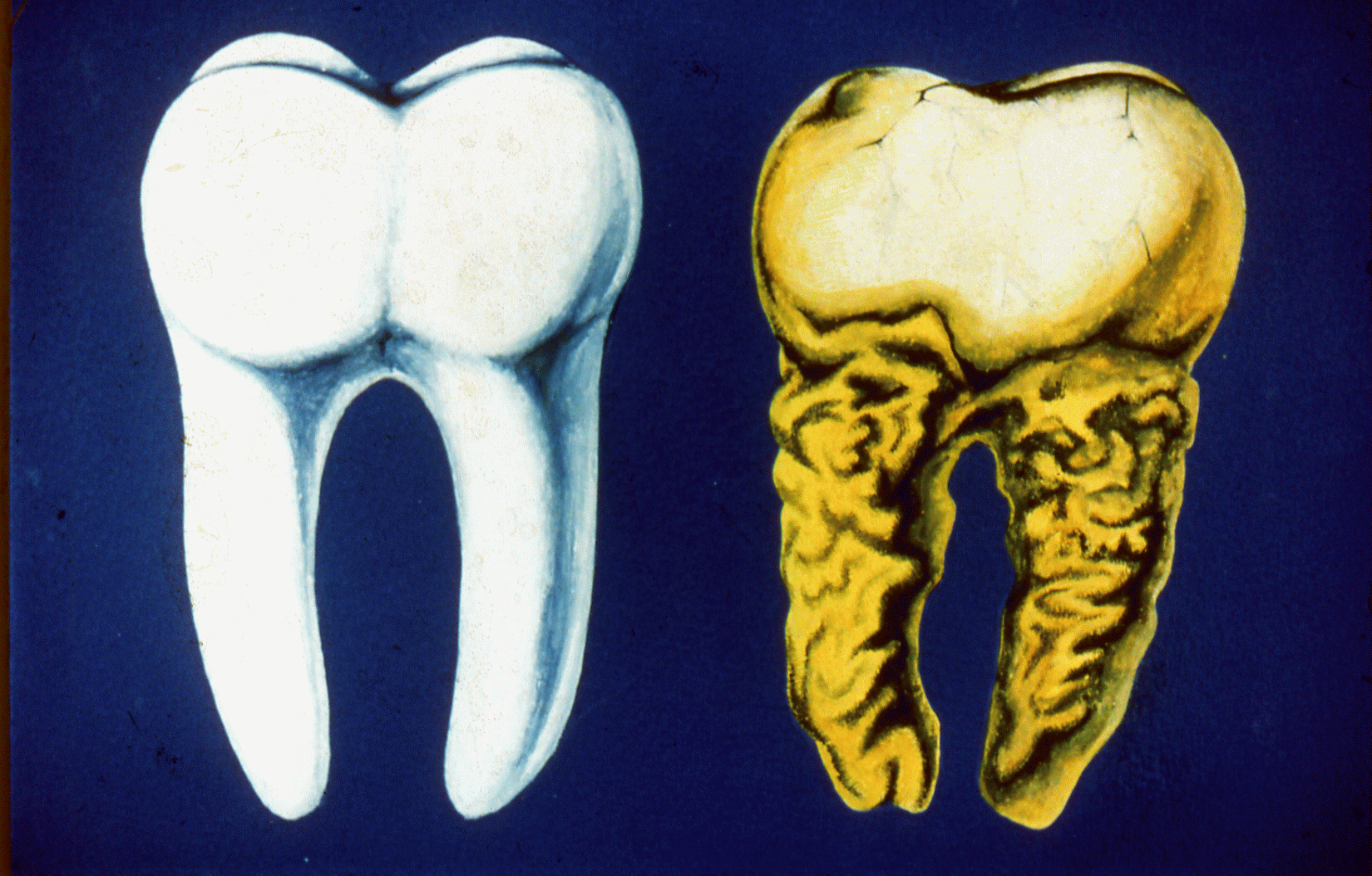 Исследовательская работа Как сохранить зубы здоровыми?