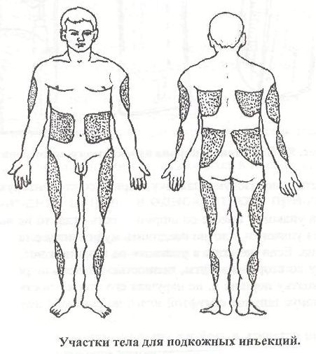 Какие участки тела. Анатомические области для внутрикожных и подкожных инъекций. Анатомические области введения внутрикожной инъекции и подкожной. Анатомические места введения инсулина. Места введения подкожной инъекции рисунок.