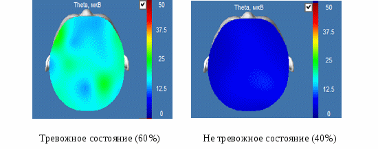 СТАТЬЯ ЭЭГ-ПАТТЕРНЫ УРОВНЯ ТРЕВОЖНОСТИ ЖИТЕЛЕЙ ДОНБАССА