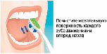 Буклет Здоровые зубы - красивая улыбка