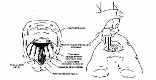 Алгоритмы неотложной помощи в картинках