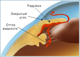 Консультация Учителю о глазных заболеваниях