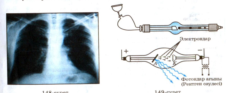 ФизикаданРентген сәулелеріашық сабақ жоспары