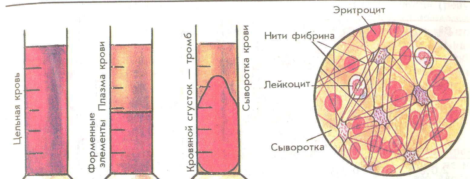 Строение тромба. Структура тромба.