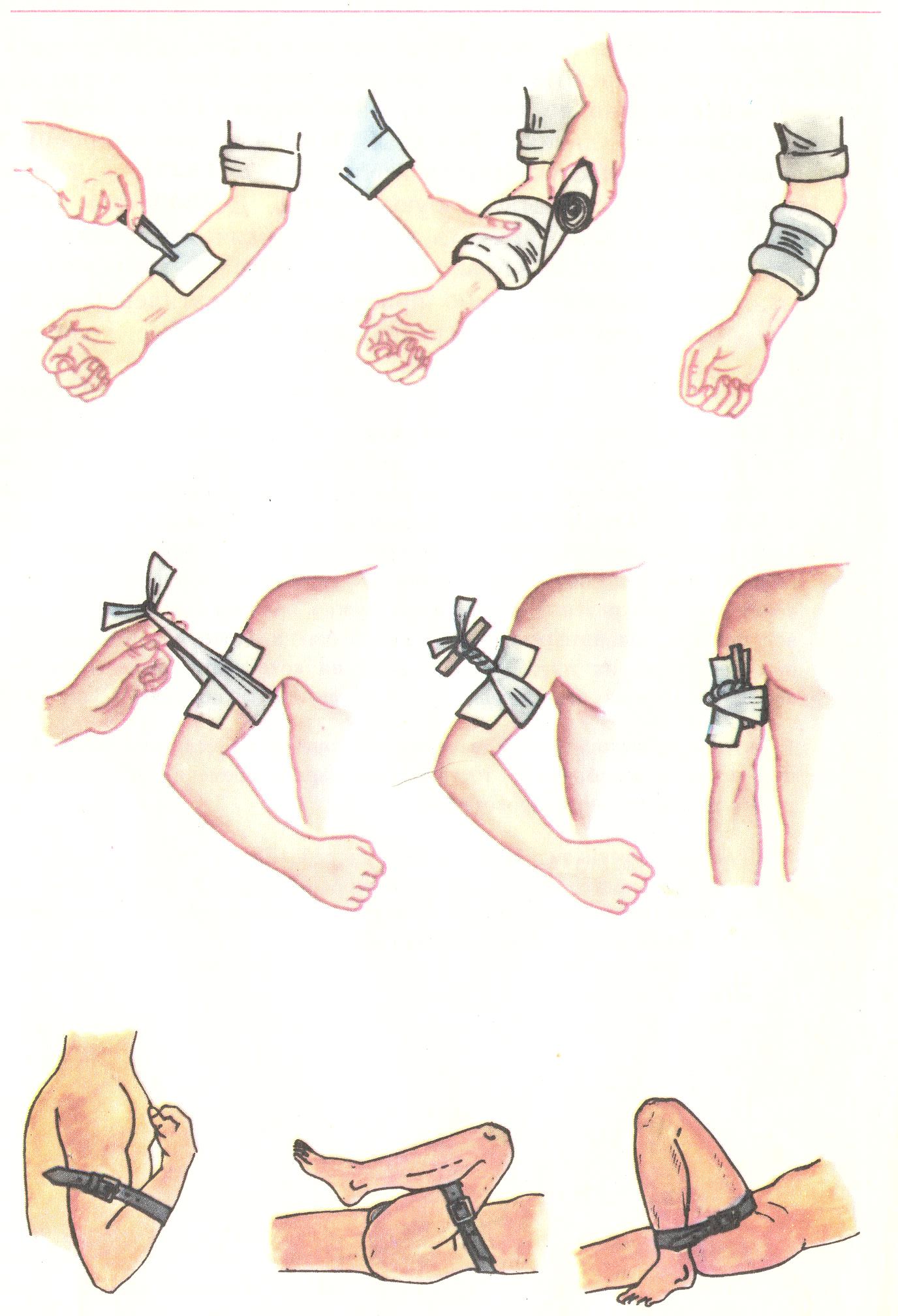 Картинка первая помощь при венозном кровотечении