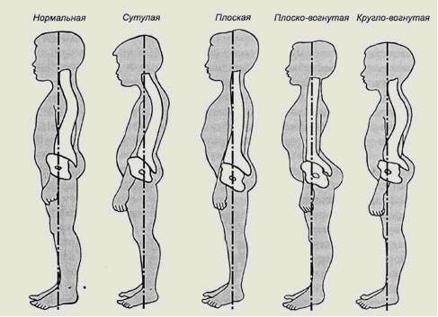 Памятка - буклет Оздоровительная и корригирующая гимнастика