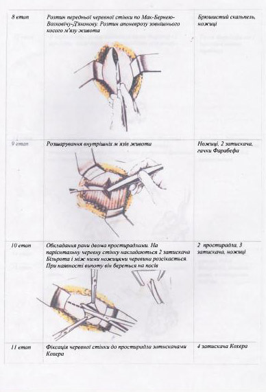 Пособие для операционной сестры