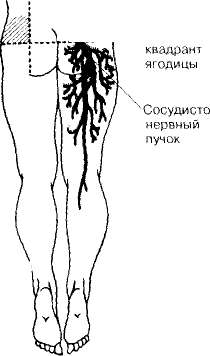 Обучающее пособие практического занятия для студента Внутримышечное введение лекарственных средств