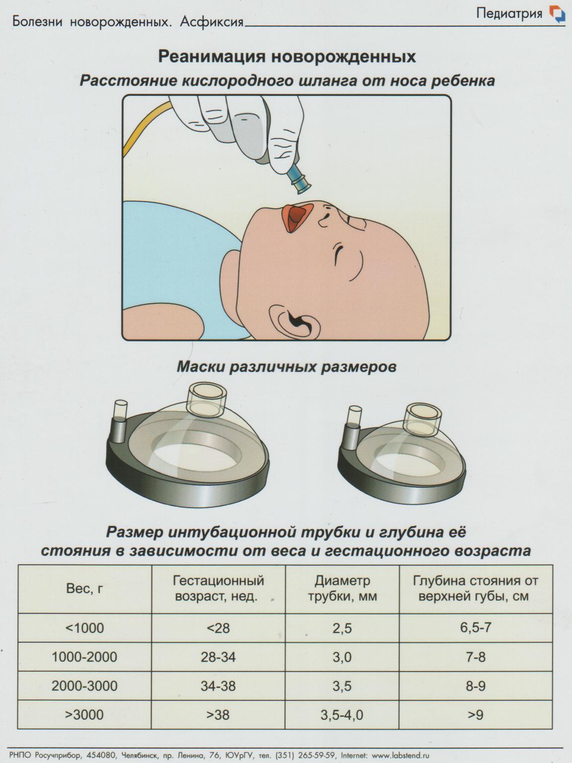 Асфиксия новорожденного рекомендации