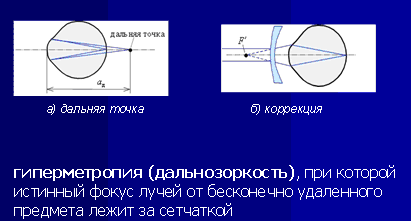 Конспект урока «Глаз как оптическая система»