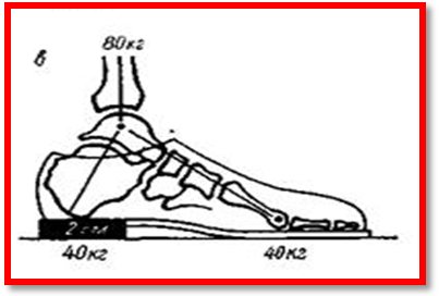 Доклад к презентации: Вред высоких каблуков с точки зрения физики.