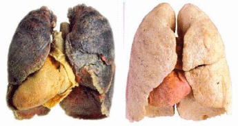 Влияние табакокурения на организм человека