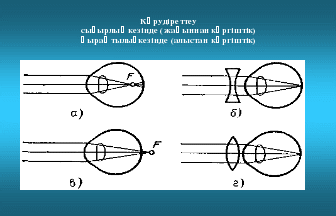 Ашық сабақ: Көздің құрылысы