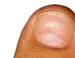 Исследовательская работа «Диагностика заболеваний по ногтевым пластинкам».