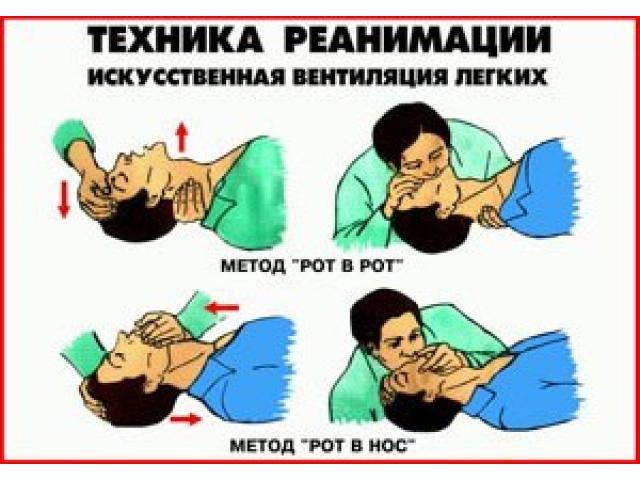 Методическая разработка урока по БЖД на тему: «Смерть. Признаки клинической и биологической смерти. Техника проведения непрямого массажа сердца и искусственной вентиляции легких»