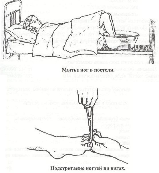 Гигиенический уход за больными. Мытье ног тяжелобольного пациента. Мытье тяжелобольного пациента в постели алгоритм. Мытье тяжелобольного пациента в постели. Мытье ног в постели тяжелобольному пациенту.