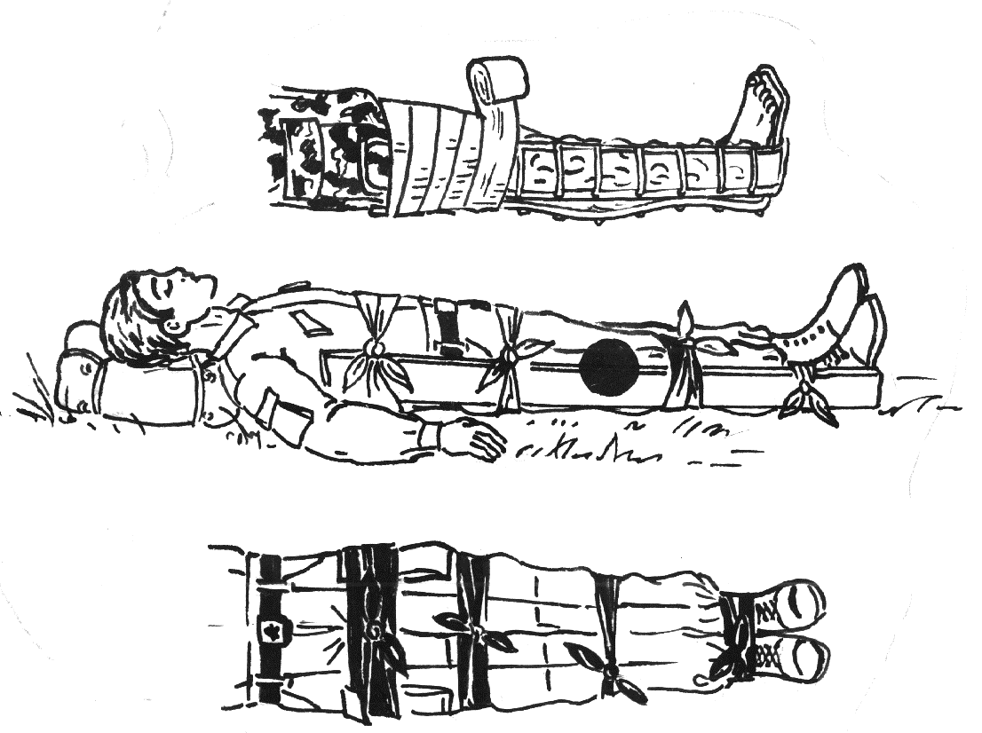 Транспортная иммобилизация нижней конечности. Транспортная иммобилизация. Транспортная иммобилизация военнослужащих. Транспортная иммобилизация при ранах. Раны иммобилизация ПМП.