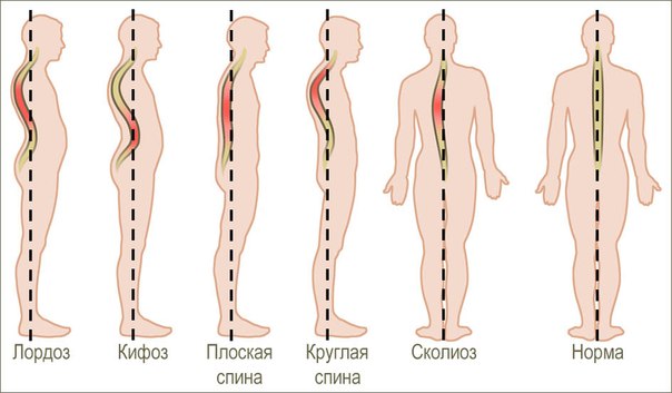 Исследовательская работа на тему Влияние массы школьного ранца на здоровье ученика