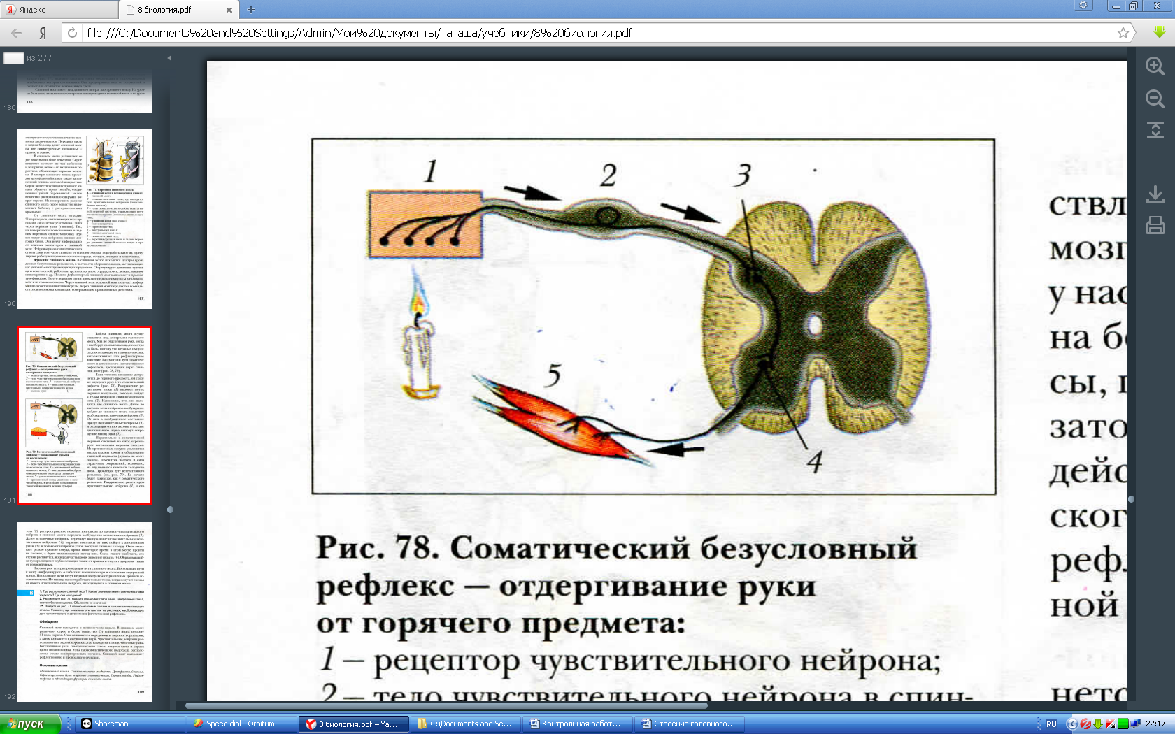 Схема рефлекторной дуги отдергивания руки от горячего предмета рисунок