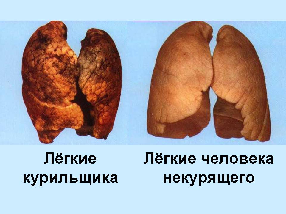 Из опыта работы по пропаганде здорового образа жизни