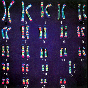 Урок «Хромосомный набор человека. Заболевания и дефекты, связанные с патологией хромосомного набора»